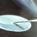Spoon